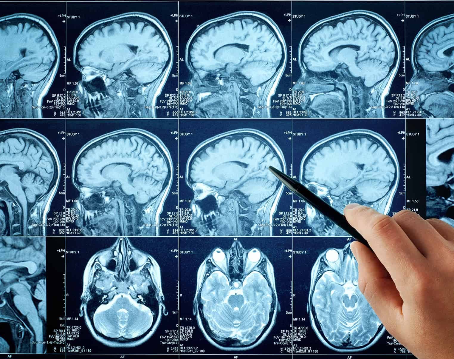 Medical malpractice lawyers Miami